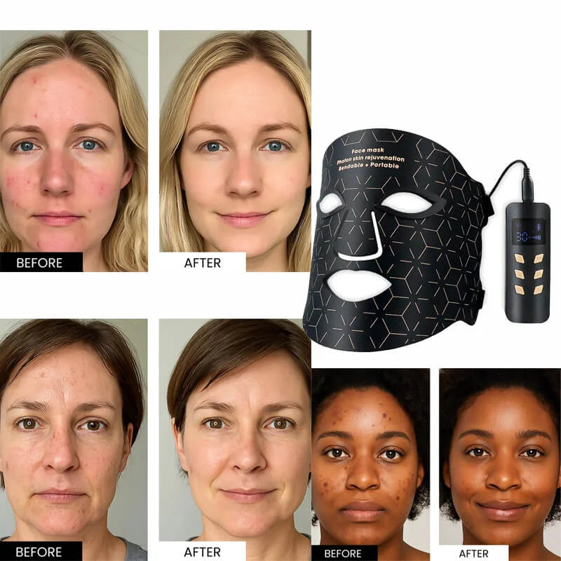 Eleganse LED Mask