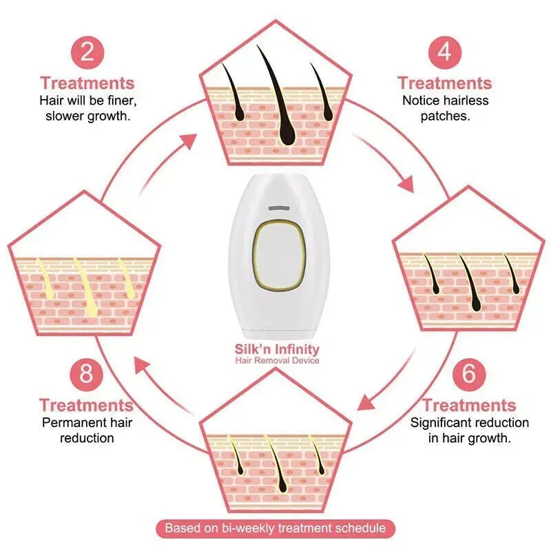 opheline GlowSilk IPL Hair Removal Handset-Smooth Skin at Home